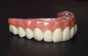 all-on-4 dental implants north dakota
