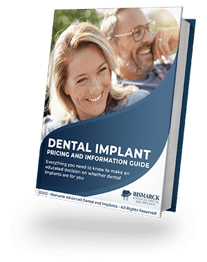 bismarck dental implant brochure
