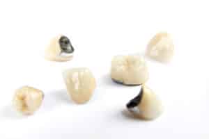 dental crowns in bismarck north dakota