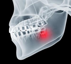 Oral Surgery and Tooth Extractions Oral Surgery and Tooth Extractions North Dakota Bismarck Advanced Detnal