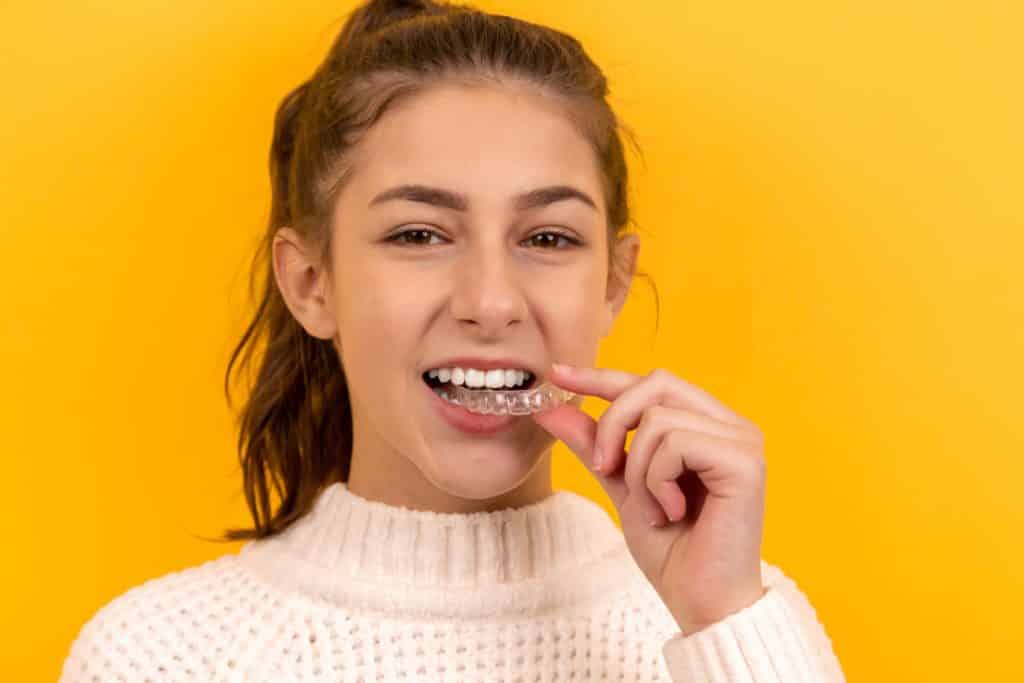 Invisalign Treatment Invisalign Treatment