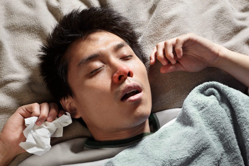 A male Chinese man is sleeping while catching cold and breathing through mouth because of the flu. Mouth Breathing Affect