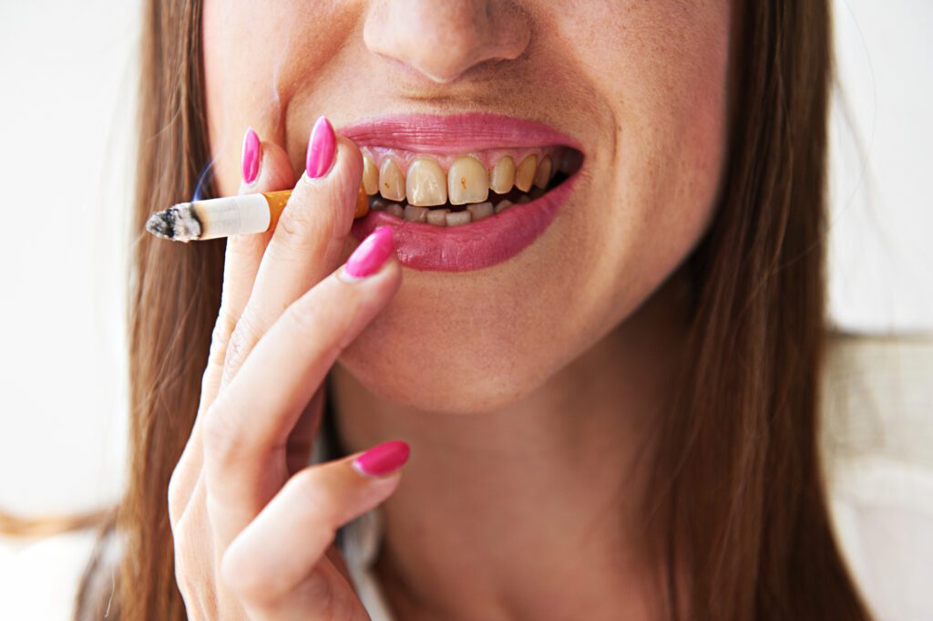 Unveiling 6 Oral Health Risks Of Vaping vaping, oral risks, bismarck, ND