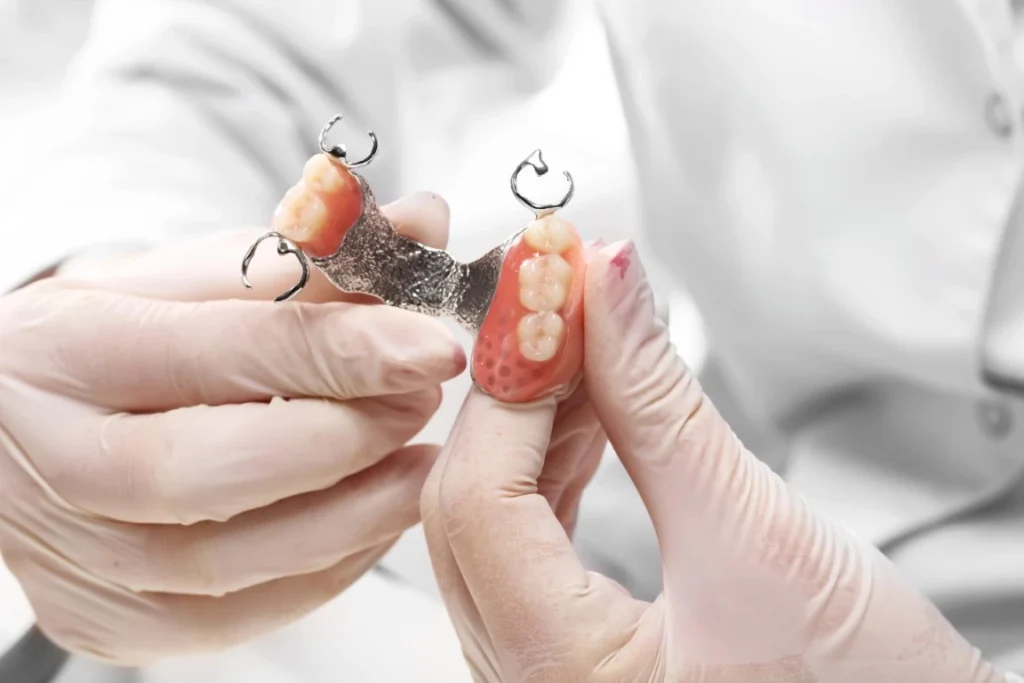 Are you too young to get dentures, Bismarck, ND