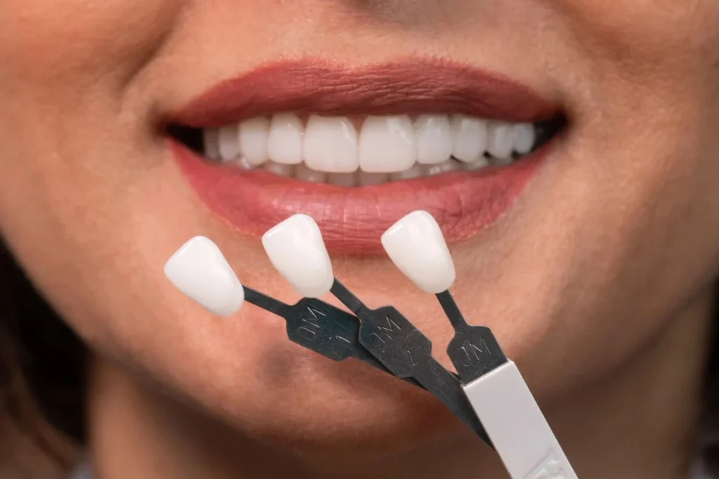 Full Mouth Reconstruction: Everything You Need to Know Before Your Appointment Full Mouth Reconstruction - Bismarck, ND
