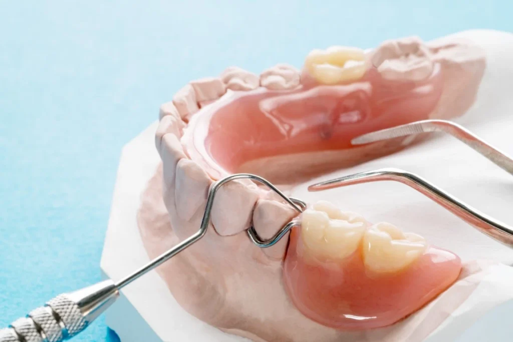 Dental Implants Vs. Flippers: Choosing A Permanent Solution For Your Summer Photos Flippers - Bismarck, ND