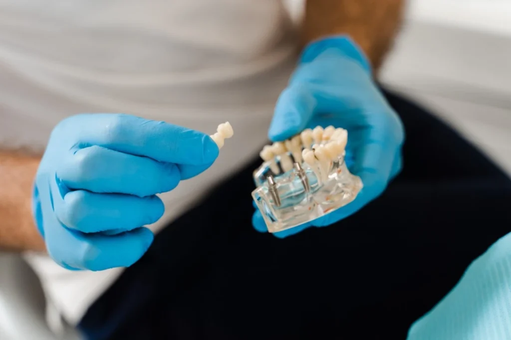 Are Dental Implants An Investment Or An Expense? Breaking Down The 20-Year Cost Investment - Bismarck, ND